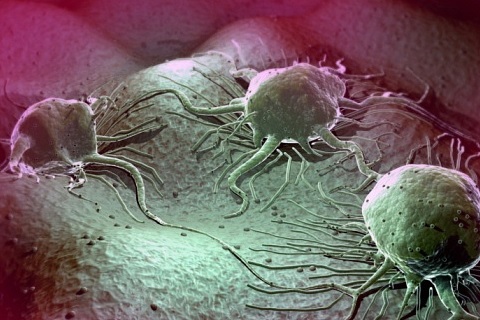 Фото раковых клеток