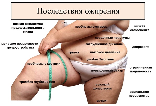 Последствия ожирения для организма